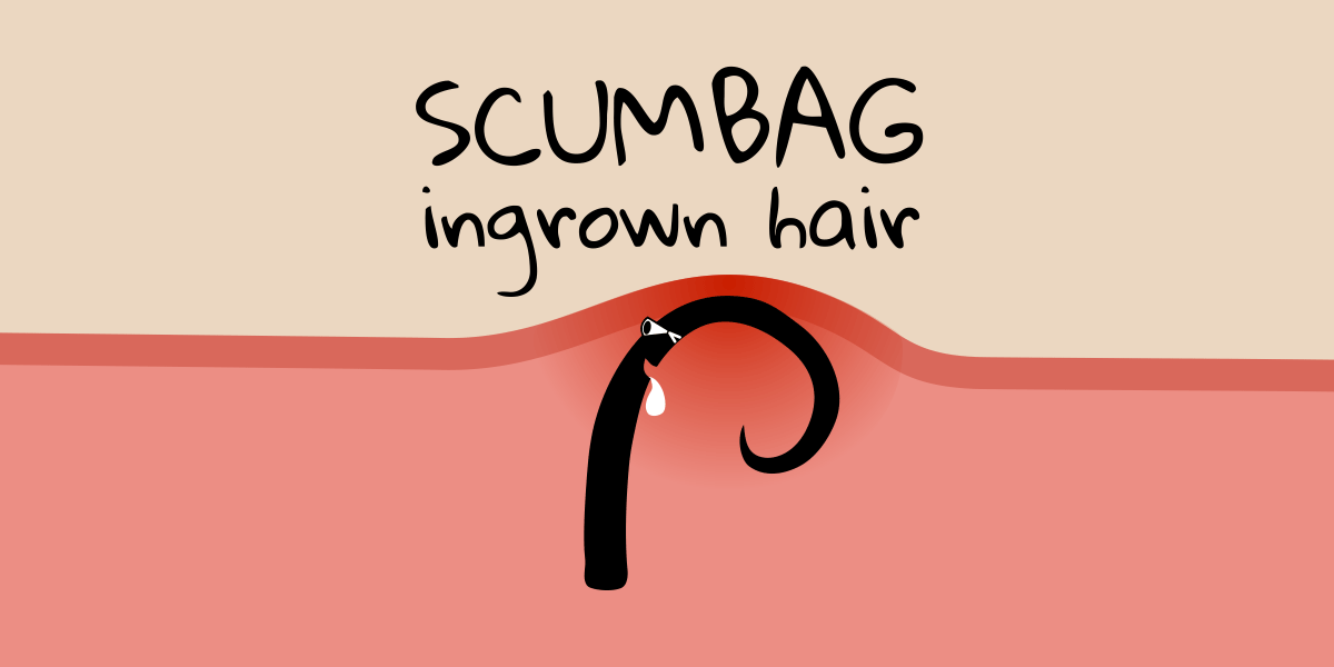 Scumbag Ingrown Hair Pigtelligent